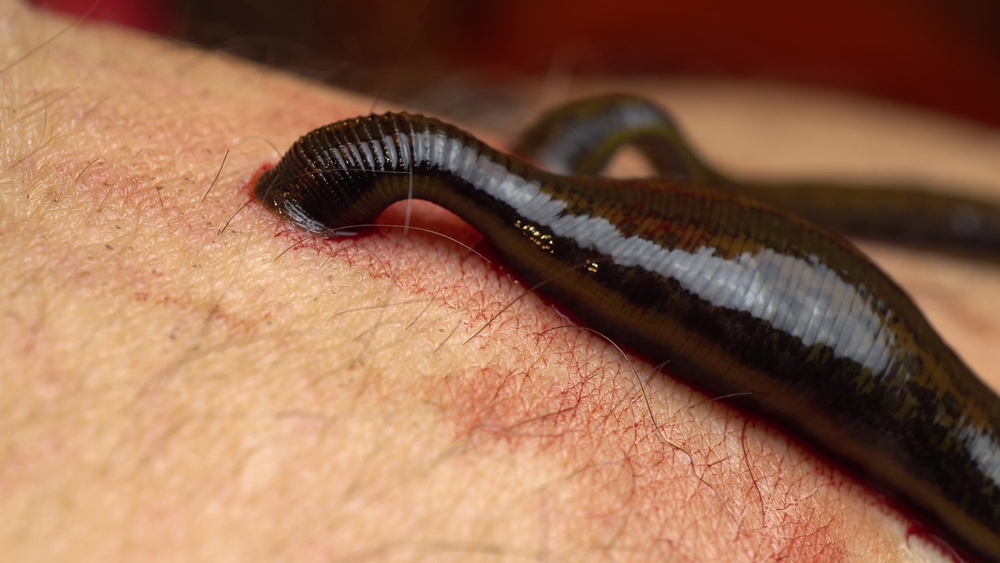 Close-up of a leech attached to a human arm.