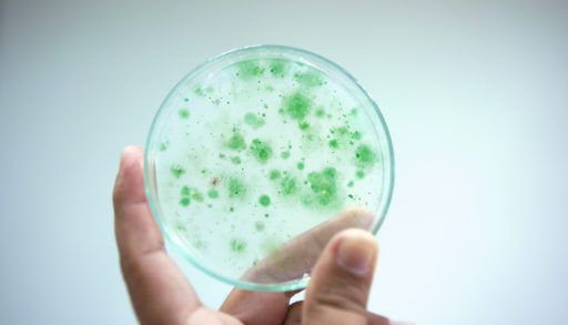 Colony of blue green algae in culture medium plate, Microbiology.