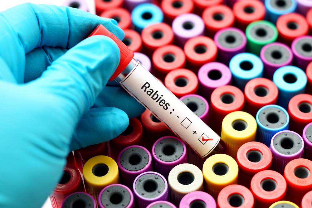 A gloved hand holding a positive rabies test